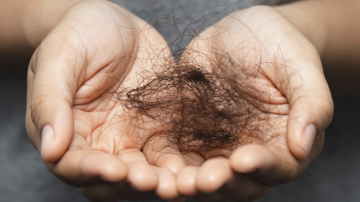 Common Hair Loss Causes Explained by Experts